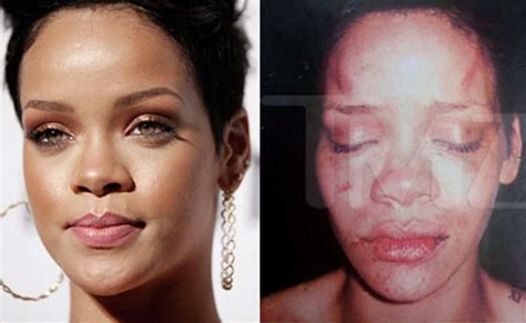 rihanna leaked pics|Rihanna beating photos: Police that leaked the。